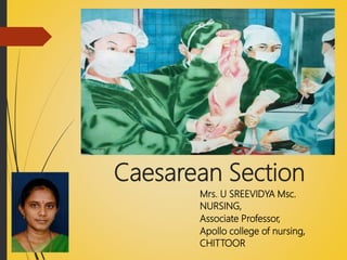 Caesarean Section
Mrs. U SREEVIDYA Msc.
NURSING,
Associate Professor,
Apollo college of nursing,
CHITTOOR
 