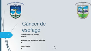 Cáncer de
esófago
Catedrático: Dr. Ángel
Porras
Alumno: D. Armando Méndez
A.
ONCOLOGI
A
5°
“I”
1
 