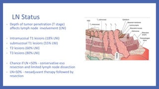 Ca esophagus 12th | PPTX