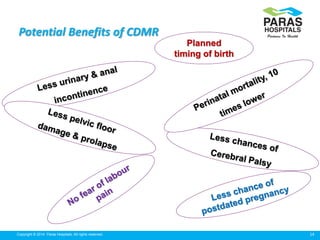 Caesarean delivery by Maternal Request (CDMR) | PPTX