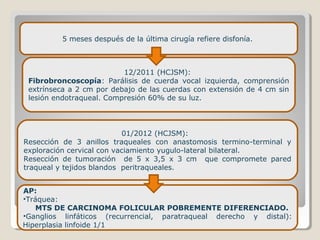 5 meses después de la última cirugía refiere disfonía.
12/2011 (HCJSM):
Fibrobroncoscopía: Parálisis de cuerda vocal izquierda, comprensión
extrínseca a 2 cm por debajo de las cuerdas con extensión de 4 cm sin
lesión endotraqueal. Compresión 60% de su luz.
01/2012 (HCJSM):
Resección de 3 anillos traqueales con anastomosis termino-terminal y
exploración cervical con vaciamiento yugulo-lateral bilateral.
Resección de tumoración de 5 x 3,5 x 3 cm que compromete pared
traqueal y tejidos blandos peritraqueales.
AP:
•Tráquea:
MTS DE CARCINOMA FOLICULAR POBREMENTE DIFERENCIADO.
•Ganglios linfáticos (recurrencial, paratraqueal derecho y distal):
Hiperplasia linfoide 1/1
 