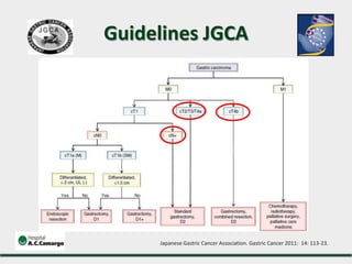 Japanese Gastric Cancer Association. Gastric Cancer 2011: 14: 113-23.
Guidelines JGCA
 