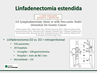 • Linfadenectomia D2 vs. D2 + retroperitoneal
• 532 pacientes
• 24 hospitais
• Cirurgião – 100 gastrectomias
• Hospital – mais de 80 / ano
• Mortalidade – 1%
Linfadenectomia estendida
 