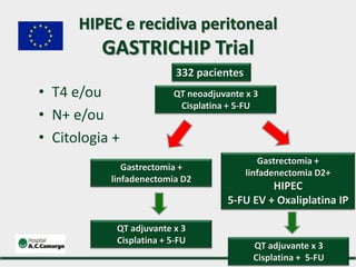 • T4 e/ou
• N+ e/ou
• Citologia +
332 pacientes
QT neoadjuvante x 3
Cisplatina + 5-FU
HIPEC e recidiva peritoneal
GASTRICHIP Trial
QT adjuvante x 3
Cisplatina + 5-FU
Gastrectomia +
linfadenectomia D2
QT adjuvante x 3
Cisplatina + 5-FU
Gastrectomia +
linfadenectomia D2+
HIPEC
5-FU EV + Oxaliplatina IP
 