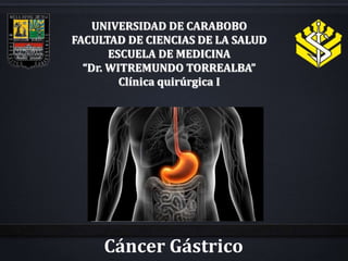 Cáncer Gástrico
UNIVERSIDAD DE CARABOBO
FACULTAD DE CIENCIAS DE LA SALUD
ESCUELA DE MEDICINA
“Dr. WITREMUNDO TORREALBA”
Clínica quirúrgica I
 