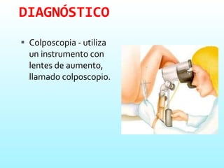 DIAGNÓSTICO Colposcopia - utiliza un instrumento con lentes de aumento, llamado colposcopio. 