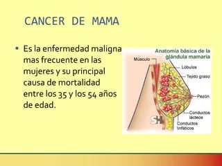 CANCER DE MAMA Es la enfermedad maligna mas frecuente en las mujeres y su principal causa de mortalidad entre los 35 y los 54 años de edad. 