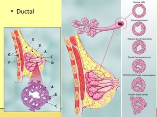 Ductal 