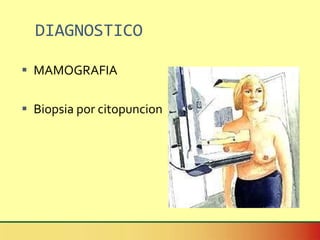 DIAGNOSTICO MAMOGRAFIA Biopsia por citopuncion 