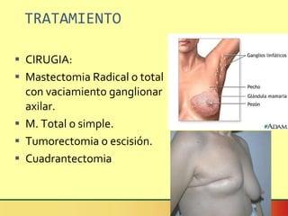TRATAMIENTO CIRUGIA: Mastectomia Radical o total con vaciamiento ganglionar axilar. M. Total o simple. Tumorectomia o escisión. Cuadrantectomia 