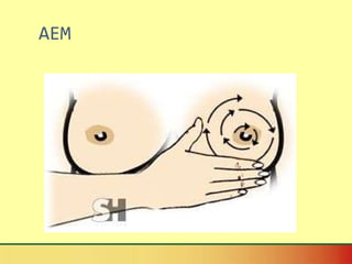 AEM 