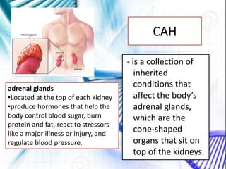 CAH
- is a collection of
inherited
conditions that
affect the body’s
adrenal glands,
which are the
cone-shaped
organs that sit on
top of the kidneys.
adrenal glands
•Located at the top of each kidney
•produce hormones that help the
body control blood sugar, burn
protein and fat, react to stressors
like a major illness or injury, and
regulate blood pressure.
 