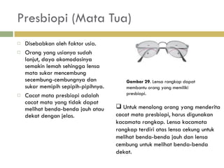 Presbiopi (Mata Tua) Disebabkan oleh faktor usia.  Orang yang usianya sudah lanjut, daya akomodasinya semakin lemah sehingga lensa mata sukar mencembung secembung-cembungnya dan sukar memipih sepipih-pipihnya. Cacat mata presbiopi adalah cacat mata yang tidak dapat melihat benda-benda jauh atau dekat dengan jelas.  Gambar 29 . Lensa rangkap dapat membantu orang yang memiliki presbiopi. Untuk menolong orang yang  menderita cacat mata presbiopi, harus digunakan kacamata  rangkap. Lensa kacamata rangkap terdiri atas lensa cekung untuk melihat benda-benda jauh dan lensa cembung untuk melihat benda-benda dekat. 