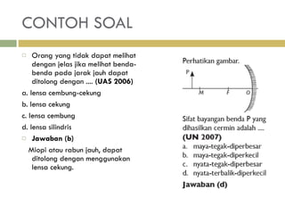 CONTOH SOAL Orang yang tidak dapat melihat dengan jelas jika melihat benda-benda pada jarak jauh dapat ditolong dengan ....  (UAS 2006) a. lensa cembung-cekung b. lensa cekung c. lensa cembung d. lensa silindris Jawaban (b) Miopi atau rabun jauh, dapat ditolong dengan menggunakan lensa cekung. 