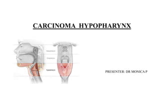 CARCINOMA HYPOPHARYNX
PRESENTER: DR MONICA P
 