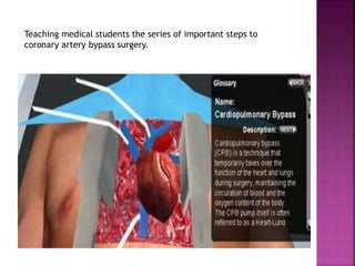 Teaching medical students the series of important steps to
coronary artery bypass surgery.
 