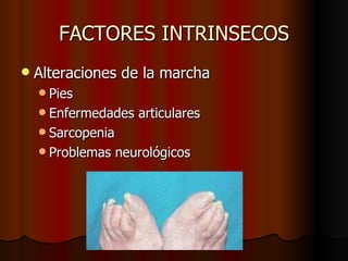 FACTORES INTRINSECOS Alteraciones de la marcha Pies Enfermedades articulares Sarcopenia Problemas neurológicos 