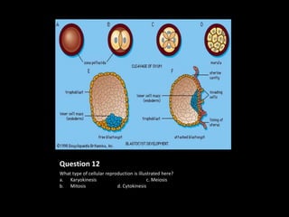 Question 12
What type of cellular reproduction is illustrated here?
a. Karyokinesis                            c. Meiosis
b. Mitosis                 d. Cytokinesis
 