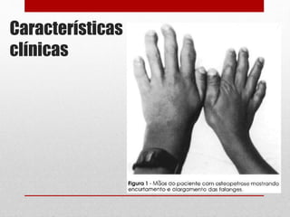 Características
clínicas
 