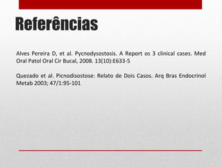 Referências
Alves Pereira D, et al. Pycnodysostosis. A Report os 3 clinical cases. Med
Oral Patol Oral Cir Bucal, 2008. 13(10):E633-5
Quezado et al. Picnodisostose: Relato de Dois Casos. Arq Bras Endocrinol
Metab 2003; 47/1:95-101
 