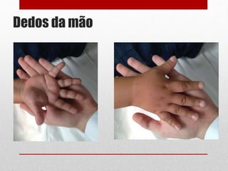 Dedos da mão
 