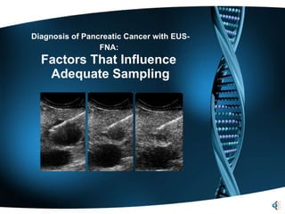Diagnosis of Pancreatic Cancer with EUS-FNA:   Factors That Influence  Adequate Sampling 