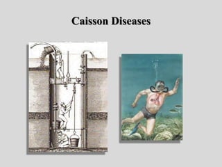 Caisson Diseases
 