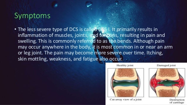 caisson s disease caisson disease