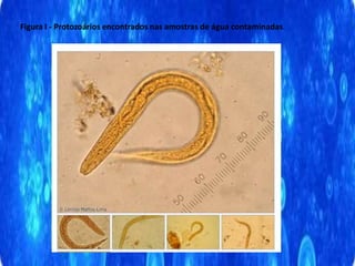 Figura I - Protozoários encontrados nas amostras de água contaminadas.
 
