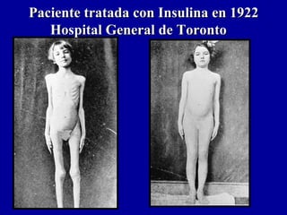Paciente tratada con Insulina en 1922Paciente tratada con Insulina en 1922
Hospital General de TorontoHospital General de Toronto
 