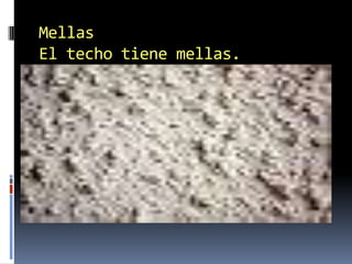 MellasEl techotienemellas.