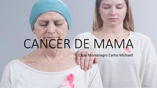 CANCER DE MAMA
Cajas Montenegro Carlos Michaell
 