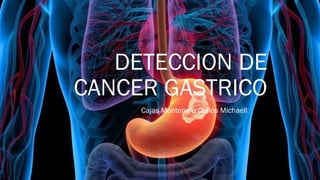 DETECCION DE
CANCER GASTRICO
Cajas Montengro Carlos Michaell
 