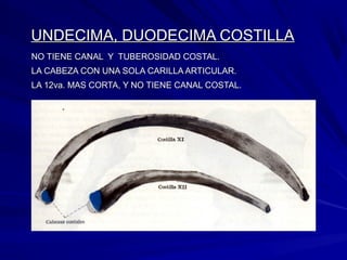UNDECIMA, DUODECIMA COSTILLAUNDECIMA, DUODECIMA COSTILLA
NO TIENE CANAL Y TUBEROSIDAD COSTAL.NO TIENE CANAL Y TUBEROSIDAD COSTAL.
LA CABEZA CON UNA SOLA CARILLA ARTICULAR.LA CABEZA CON UNA SOLA CARILLA ARTICULAR.
LA 12va. MAS CORTA, Y NO TIENE CANAL COSTAL.LA 12va. MAS CORTA, Y NO TIENE CANAL COSTAL.
 