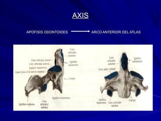AXISAXIS
• APOFISIS ODONTOIDES ARCO ANTERIOR DEL ATLASAPOFISIS ODONTOIDES ARCO ANTERIOR DEL ATLAS
 
