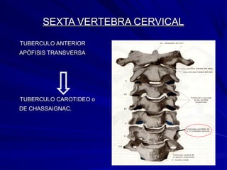 SEXTA VERTEBRA CERVICALSEXTA VERTEBRA CERVICAL
• TUBERCULO ANTERIORTUBERCULO ANTERIOR
APÓFISIS TRANSVERSAAPÓFISIS TRANSVERSA
• TUBERCULO CAROTIDEO oTUBERCULO CAROTIDEO o
DE CHASSAIGNAC.DE CHASSAIGNAC.
 