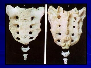 Caja toraxica y columna