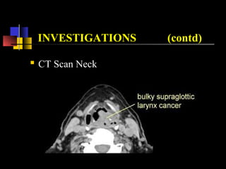 INVESTIGATIONS (contd)
 CT Scan Neck
 