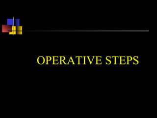 OPERATIVE STEPS
 