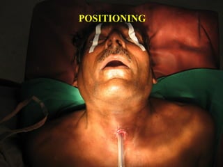 GLUCK SORENSON INCISION
 