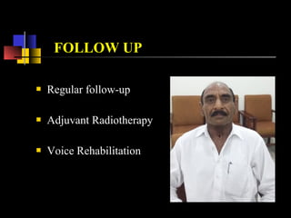 CARCINOMA LARYNX
CASE DISCUSSION
 