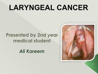 Presented by 2nd year
medical student
Ali Kareem
1
LARYNGEAL CANCER
 