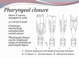 Management of Ca larynx | PPTX