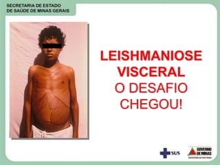LEISHMANIOSE
VISCERAL
O DESAFIO
CHEGOU!
 