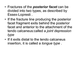Fractures of the  posterior facet  can be divided into two types, as described by Essex-Lopresti . If the fracture line producing the posterior facet fragment exits behind the posterior facet and anterior to the attachment of the tendo calcaneus:called a  joint depression type   If it exits distal to the tendo calcaneus insertion, it is called a  tongue type  . 