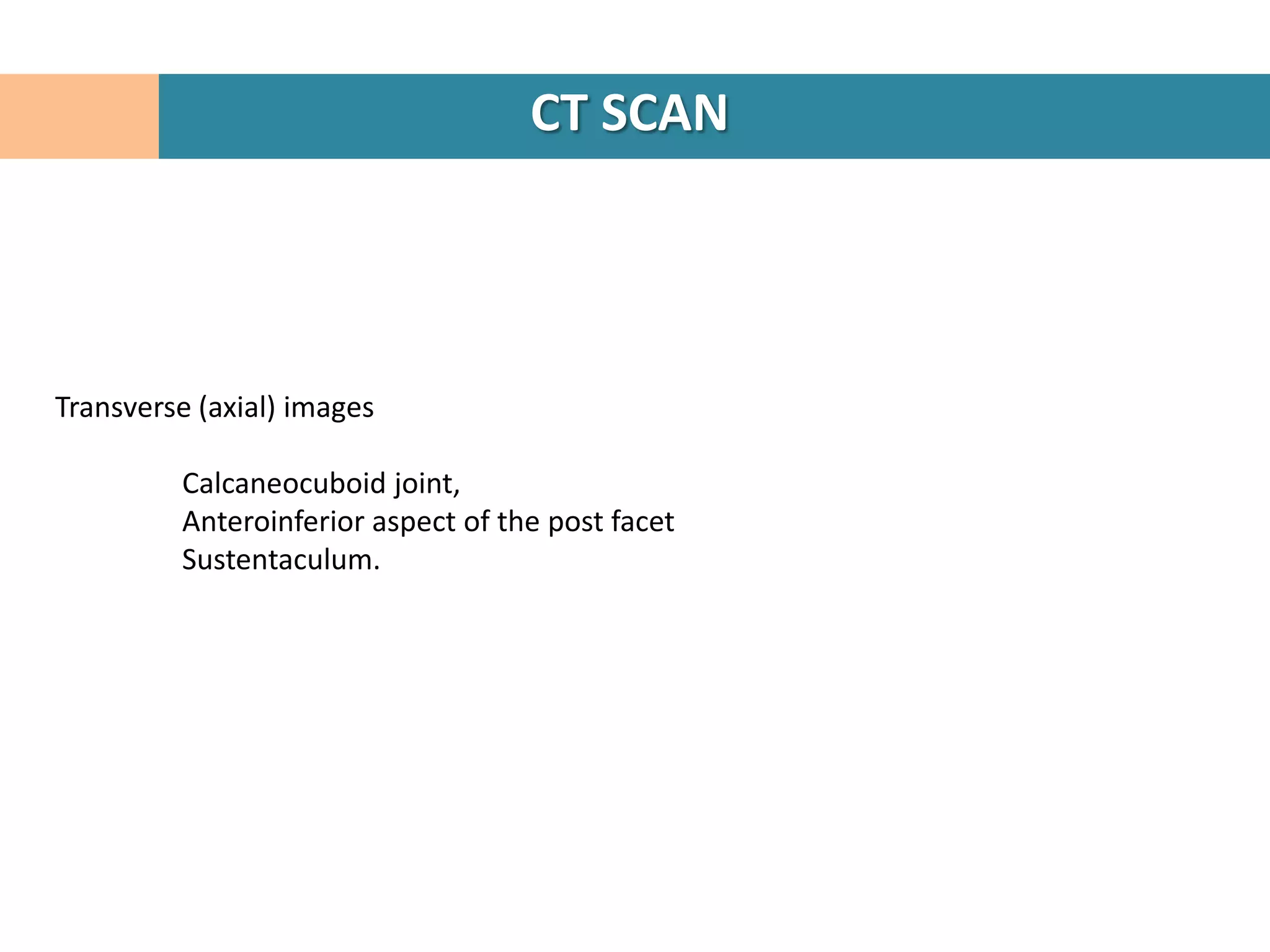 CT SCAN




Transverse (axial) images

         Calcaneocuboid joint,
         Anteroinferior aspect of the post facet
         Sustentaculum.
 