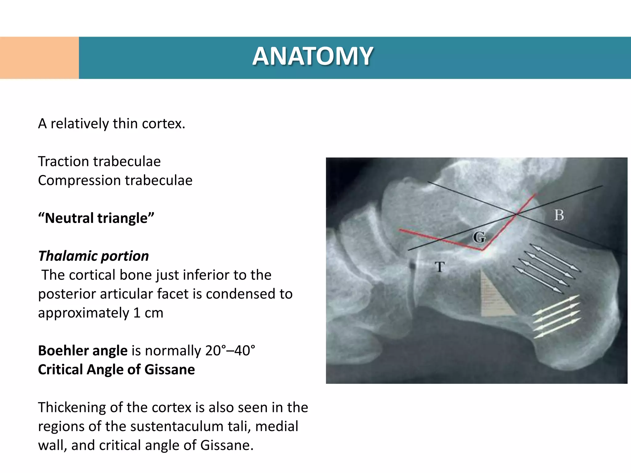ANATOMY

A relatively thin cortex.

Traction trabeculae
Compression trabeculae

“Neutral triangle”

Thalamic portion
The cortical bone just inferior to the
posterior articular facet is condensed to
approximately 1 cm

Boehler angle is normally 20°–40°
Critical Angle of Gissane

Thickening of the cortex is also seen in the
regions of the sustentaculum tali, medial
wall, and critical angle of Gissane.
 