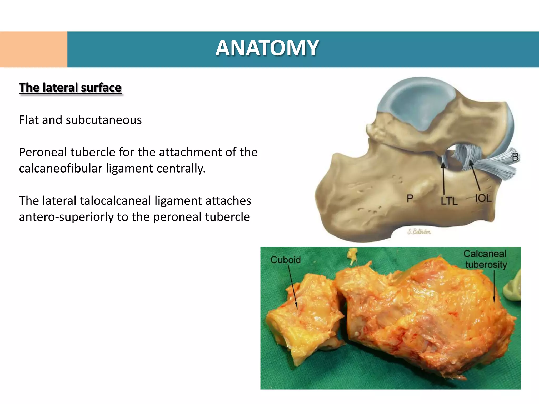 ANATOMY
The lateral surface

Flat and subcutaneous

Peroneal tubercle for the attachment of the
calcaneofibular ligament centrally.

The lateral talocalcaneal ligament attaches
antero-superiorly to the peroneal tubercle
 