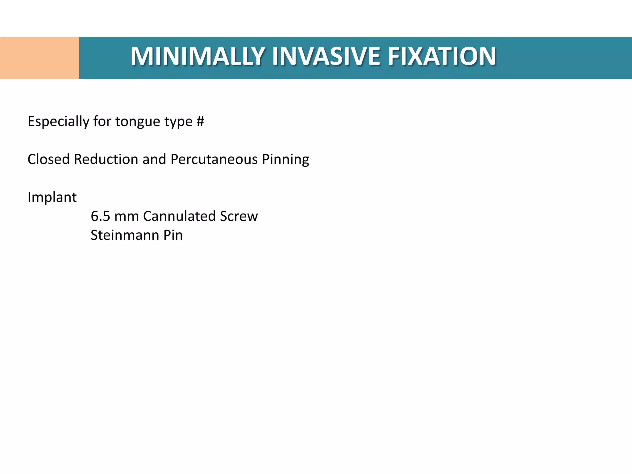 MINIMALLY INVASIVE FIXATION

Especially for tongue type #

Closed Reduction and Percutaneous Pinning

Implant
          6.5 mm Cannulated Screw
          Steinmann Pin
 
