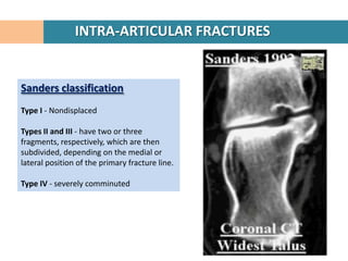 INTRA-ARTICULAR FRACTURES


Sanders classification
Type I - Nondisplaced

Types II and III - have two or three
fragments, respectively, which are then
subdivided, depending on the medial or
lateral position of the primary fracture line.

Type IV - severely comminuted
 